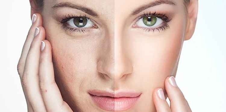 Восстановление кожи лица